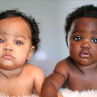 Las hermosas mellizas con diferente color de piel que sorprenden en Instagram