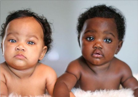 Las hermosas mellizas con diferente color de piel que sorprenden en Instagram