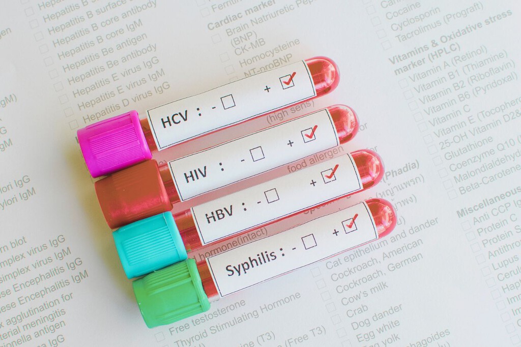 Día mundial de la salud sexual: dónde conseguir preservativos y hacerte testeos gratuitos de ITS en Buenos Aires 