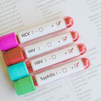 Día mundial de la salud sexual: dónde conseguir preservativos y hacerte testeos gratuitos de ITS en Buenos Aires 