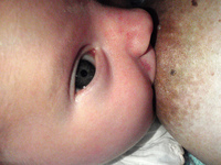 ¿Qué ocurre si mi hijo tiene el frenillo de la lengua demasiado corto? 