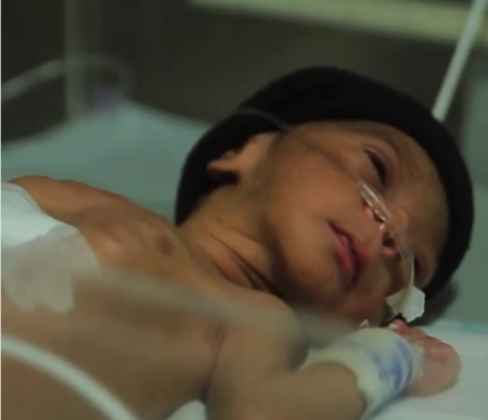 Bebe Prematuro
