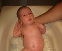 Hinchazón de las glándulas mamarias en el recién nacido