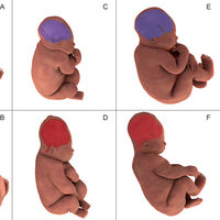 Así se deforma la cabeza del bebé durante el parto para facilitar su paso por la pelvis materna