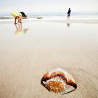 Picaduras de medusas en niños: ¿cómo prevenirlas y qué hacer?