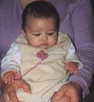 El pie zambo y el Método Ponseti