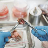 La carne de laboratorio podría ser el futuro de la comida, pero lo será antes de la medicina 