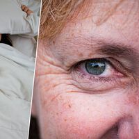 Você dorme de barriga para cima para evitar rugas? Saiba que o efeito é exatamente o contrário 