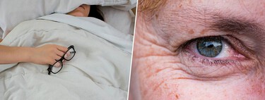 Você dorme de barriga para cima para evitar rugas? Saiba que o efeito é exatamente o contrário 
