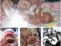 Kenna Claire, la niña que sobrevivió tras nacer con 266 gramos de peso 