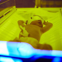 Ictericia del recién nacido: qué es y cómo se trata esta afección frecuente en los bebés