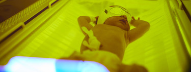 Ictericia del recién nacido: qué es y cómo se trata esta afección frecuente en los bebés