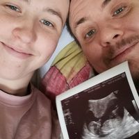 Un hombre transgénero ha dado a luz al bebé de su pareja no binaria con el esperma donado por una mujer transexual