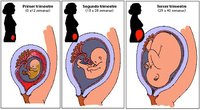 El proceso de involución uterina tras el parto