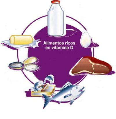 Vitamina D para disminuir el riesgo de diabetes tipo 1 en niños