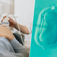 La nueva carrera por el ADN perfecto: cómo Silicon Valley compite por diseñar a la próxima generación