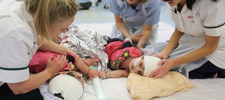 Dos hermanas siamesas unidas por la cabeza fueron separadas con éxito gracias a una donación y ya han recibido el alta