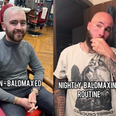 Los hombres se están rapando como muestra de masculinidad: el 'Baldmaxing' deja claro que perder pelo deja de ser un drama