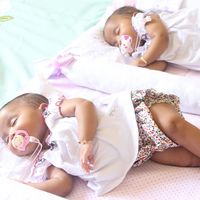 Separan exitosamente a unas siamesas unidas por el pecho y el abdomen, gracias al trabajo en equipo de 78 profesionales