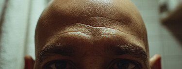 El temor de los jóvenes a quedarse calvos acaba de dar un giro inesperado: hay una comunidad de Discord buscando una cura clandestina para frenarlo