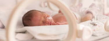Estas son las principales complicaciones de los bebés prematuros, explicadas por una pediatra 