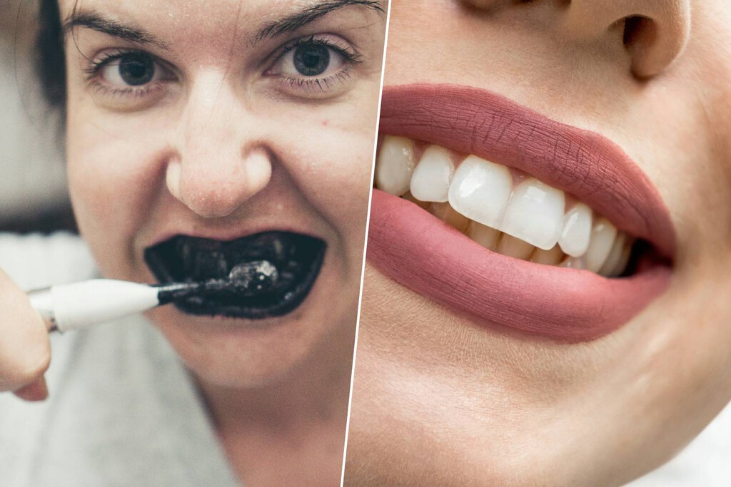 La verdad sobre la pasta de dientes con carbón activado: la peligrosa moda de TikTok que puede destrozar tu sonrisa 
