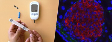 The future of the fight against type 1 diabetes lies in pancreatic islet transplants. We are solving your limitations