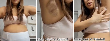 Una madre de trillizos enseña un dolorosa congestión mamaria en las axilas tras dar a luz 