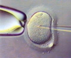 Solicitan protección laboral para las mujeres que se someten a reproducción asistida
