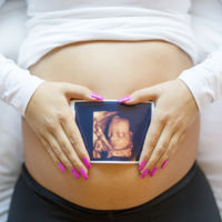 Una clínica entrega las mismas ecografías 3D a varias embarazadas y se reabre el debate de las ecografías innecesarias 