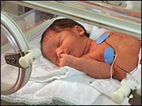 Los bebés prematuros tienen más posibilidades de convertirse en niños hiperactivos