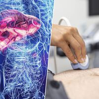 El hígado sufre en silencio: la epidemia del hígado graso que escapa a los análisis rutinarios y que la ciencia busca frenar