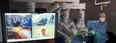 Esqueça tudo o que você sabe sobre limites na medicina: descubra como um brasileiro na China operou uma paciente a 19 mil km de distância 