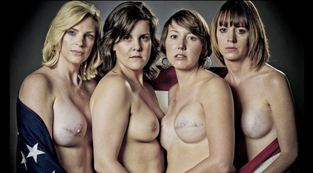 SCAR, un impactante proyecto fotográfico con supervivientes de cáncer de mama