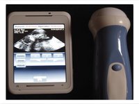 Ecografías a través del móvil