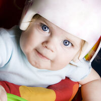 Estas son las causas de la plagiocefalia, deformidad cada vez más frecuente de la cabeza de los bebés  