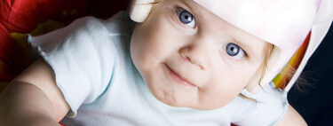 Estas son las causas de la plagiocefalia, deformidad cada vez más frecuente de la cabeza de los bebés  