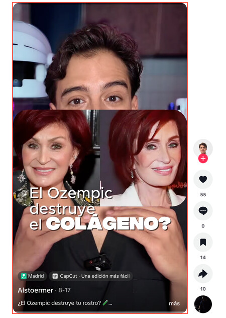 Cara De Ozempic Colageno