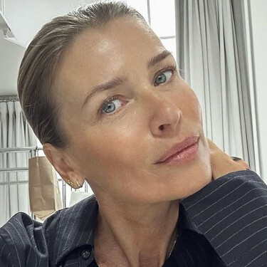 Olvídate de los ojos hinchados al despertar: estos parches con vitamina C tienen efecto buena cara al momento