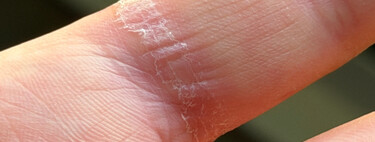 El anillo inteligente de Samsung deja marca, pero no de la forma que esperas: un usuario relata su pesadilla