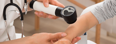 Por qué aparecen y cómo tratar las verrugas de tu hijo