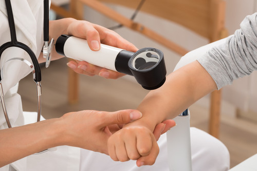 Por qué aparecen y cómo tratar las verrugas de tu hijo