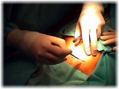 Una cesárea "natural" que imita al parto vaginal