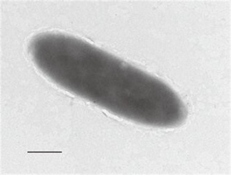 Estas bacterias se alimentan de hidrocarburos y vive en el lugar más profundo de la Tierra