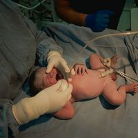 Guardar el cordón de tu hijo no es el "seguro de vida" que prometen: la ciencia apunta a otras formas de ayudar 