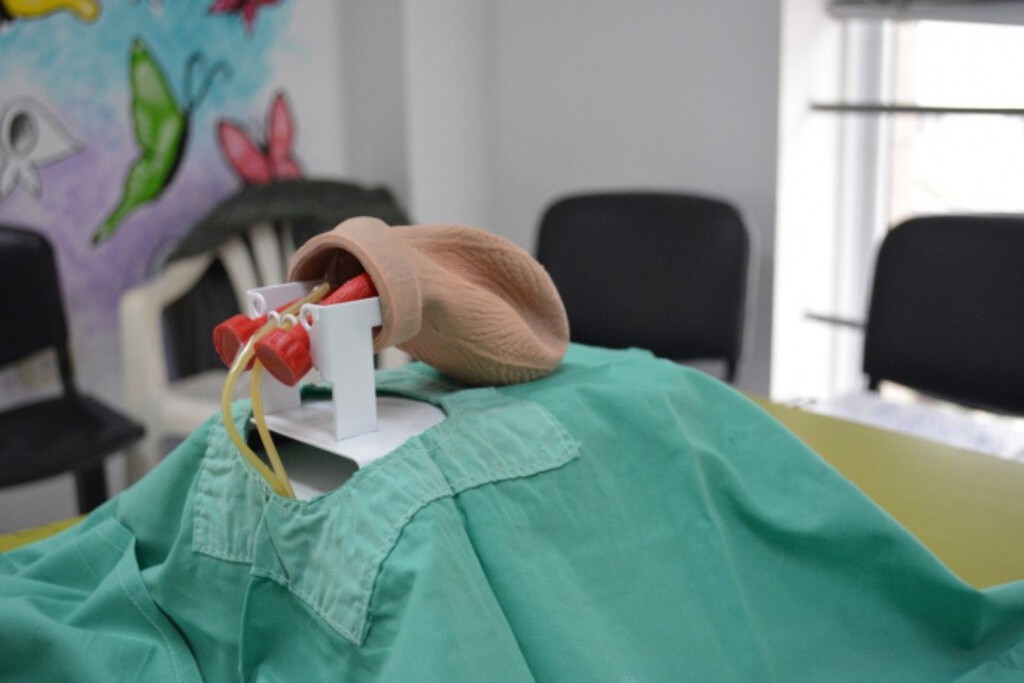 En qué hospitales públicos de Buenos Aires se realiza la vasectomía sin bisturí: cómo es este método anticonceptivo y qué efectos tiene 