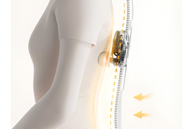 Xiaomi Launches Mi Home Smart Back Massager