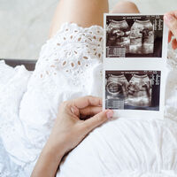 Semana 12 de embarazo: la ecografía de las 12 semanas