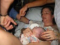 El corte tardío del cordón umbilical previene la anemia