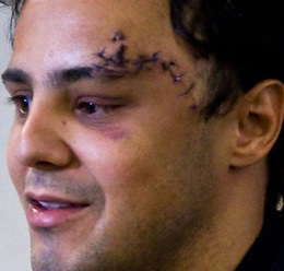 Felipe Massa en Brasil: "Quiero volver a correr lo antes posible"